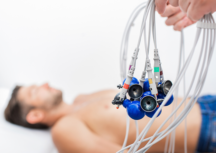 Eletrocardiograma